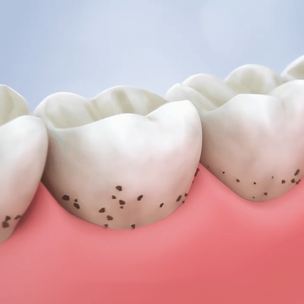 DM_20241207171203_017